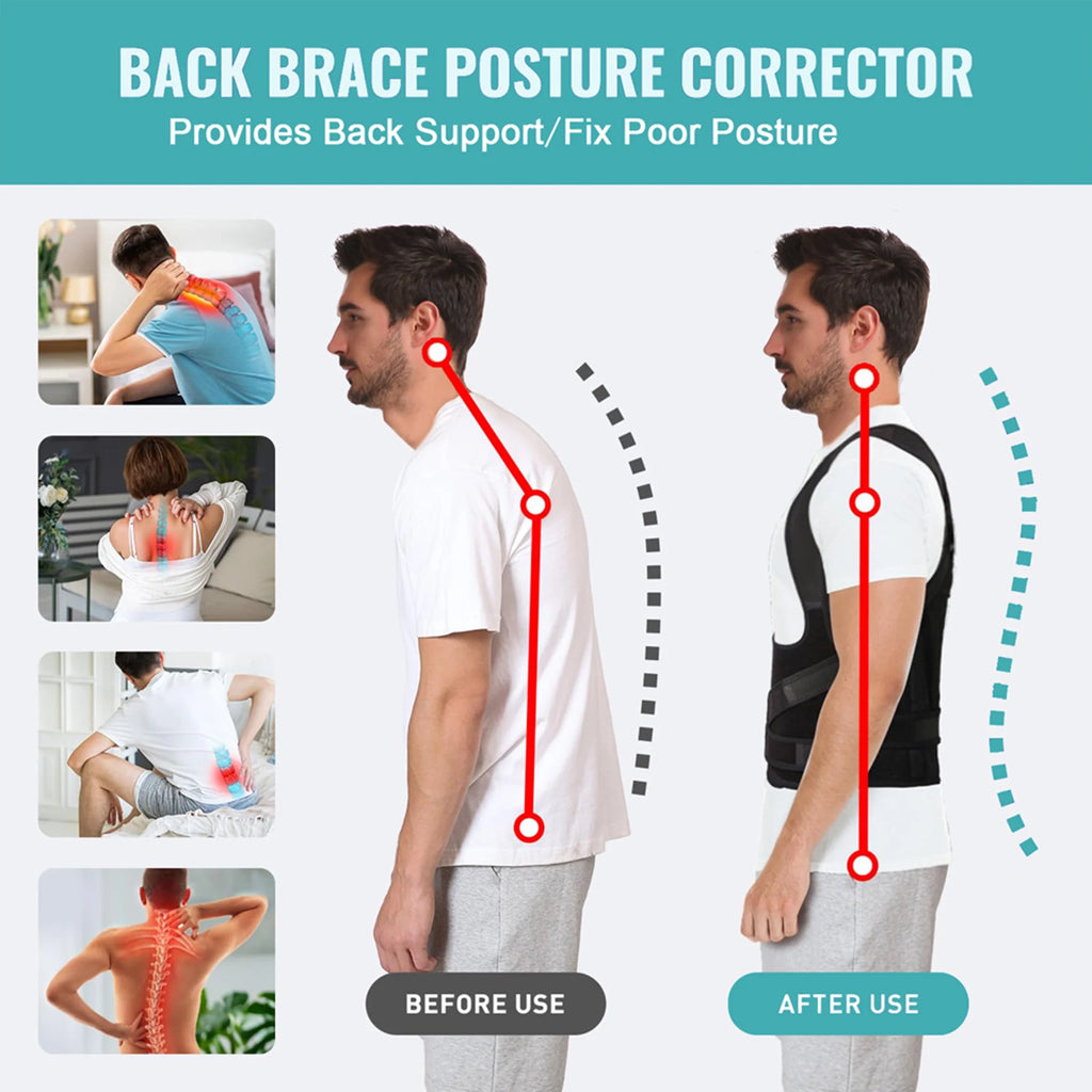 Adjustable Back Brace Posture Corrector for Men and Women, Medium
